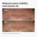The Ordinary Niacinamide 10% + Zinc 1% Serum – 30ml